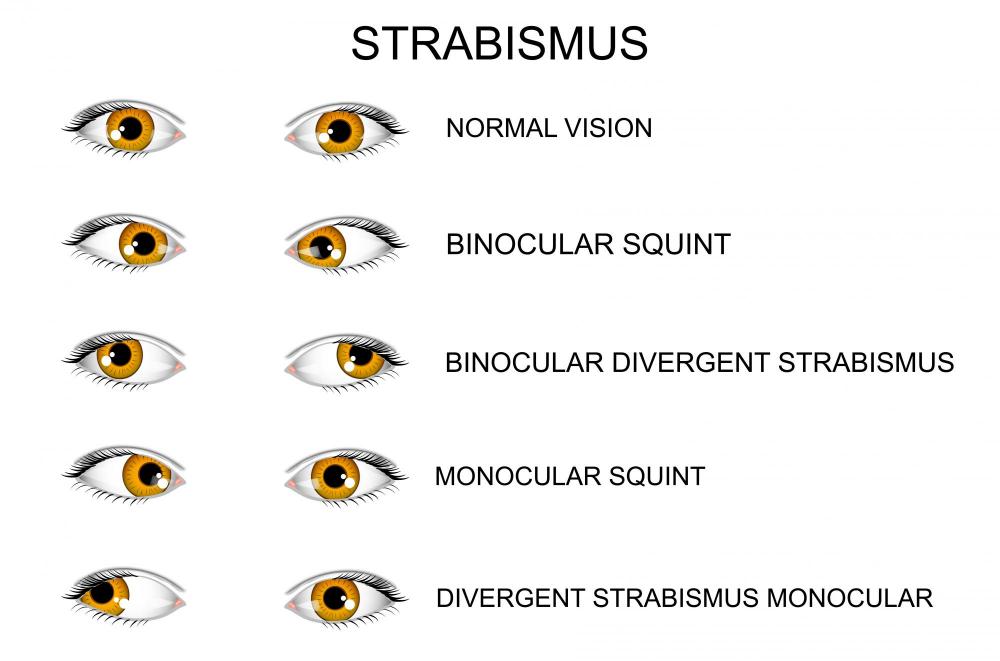 TYPES OF VISION